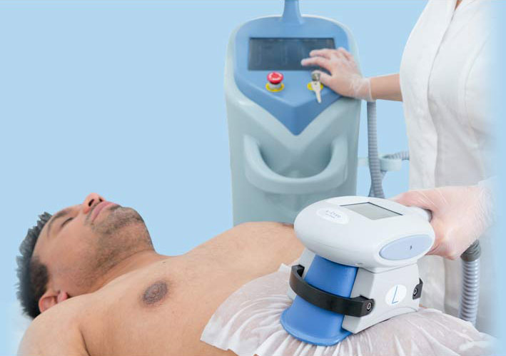 آیا دستگاه لاغری کرایولیپولیز می تواند جایگزین ورزش و رژیم غذایی شود؟