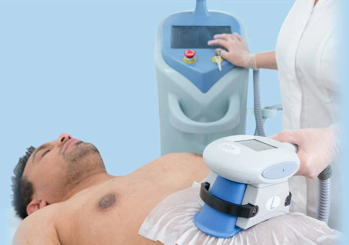 آیا دستگاه لاغری کرایولیپولیز می تواند جایگزین ورزش و رژیم غذایی شود؟