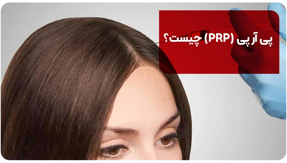 پوست پی آر پی (PRP) چیست؟
