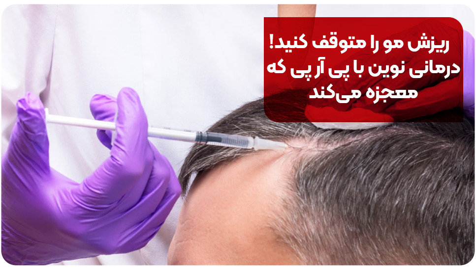 ریزش مو را متوقف کنید! درمانی نوین با پی آر پی که معجزه می کند