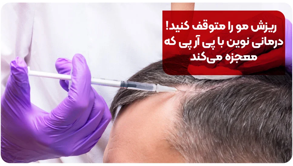 ریزش مو را متوقف کنید! درمانی نوین با پی آر پی که معجزه می کند