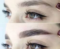 فیبروز ابرو چیست؟